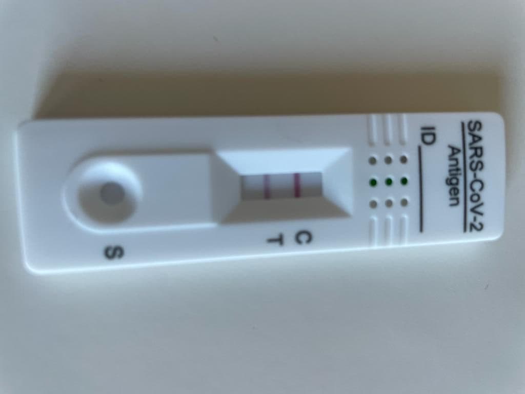Granada notifica 62 contagios, 5 ingresos hospitalarios y 3 fallecidos covid